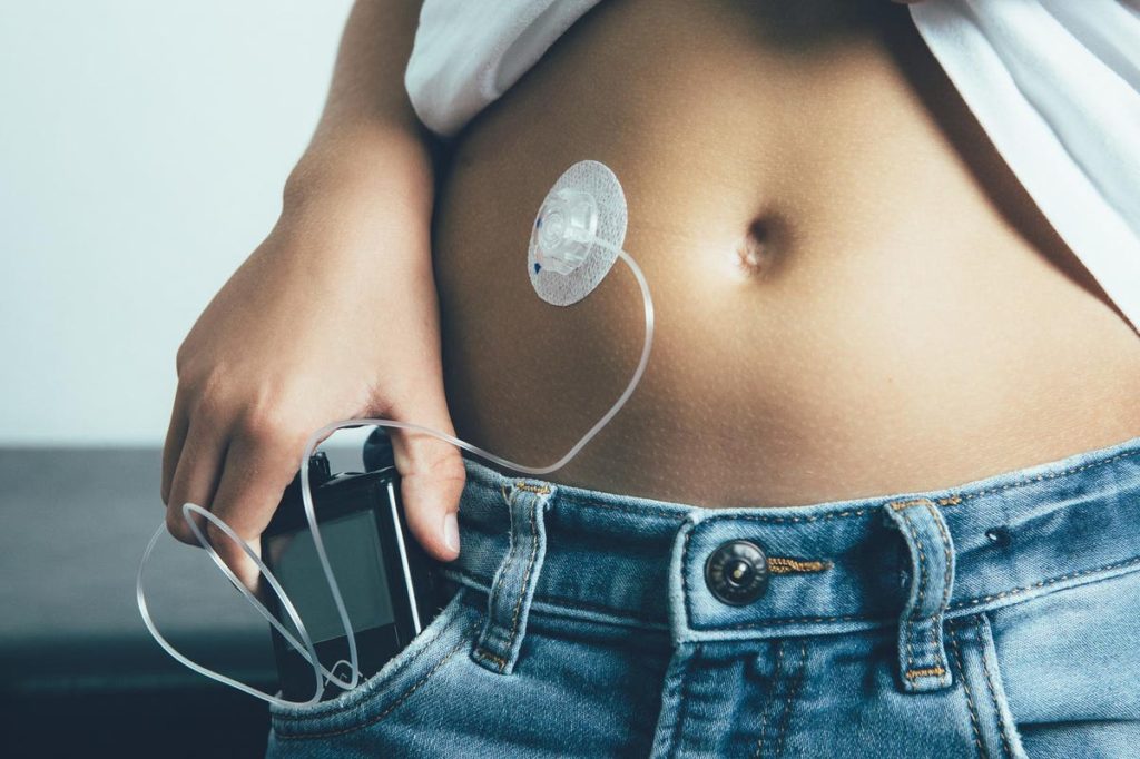 NHS in England to offer Artificial Pancreas to help manage Type 1 Diabetes | CareTutor | Social Care eLearning NHS in England to offer Artificial Pancreas to help manage Type 1 Diabetes